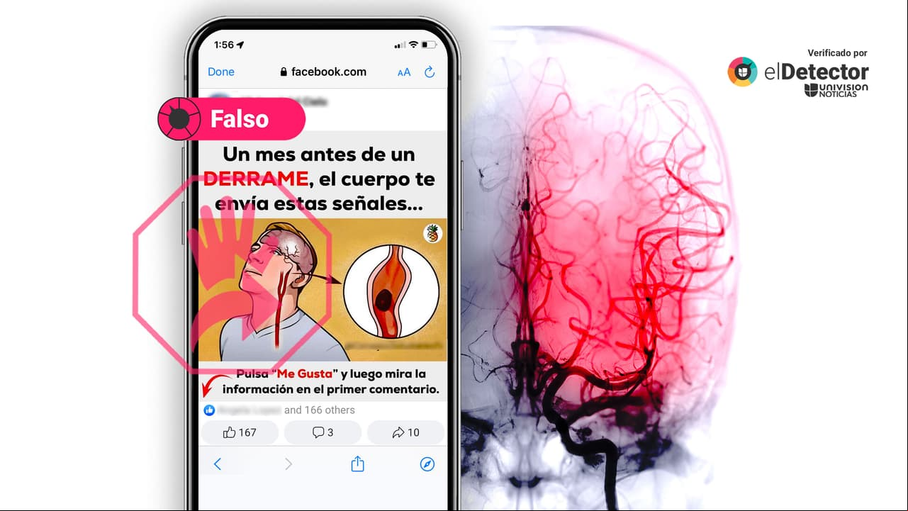 Un derrame cerebral no avisa “un mes antes”, como dicen en Facebook