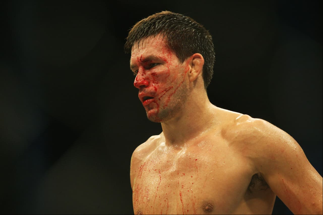 UFC Fight Island se llevará a cabo en Abu Dhabi, en la lujosa isla de Yas Island. La Isla sostendrá cuatro eventos incluido el pago por evento de la UFC 251 y se llevará a cabo entre el 11 de julio y el 25 de julio.