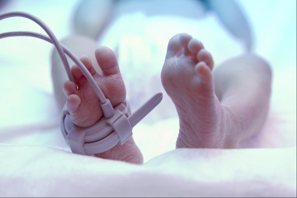 Qué es el OEIS, el extraño padecimiento con el que luchó Lucas, el hijo de Sopitas