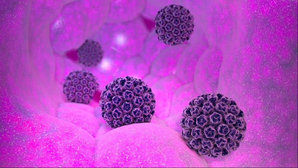Este virus común de transmisión sexual causa varios tipos de cáncer y pocos lo saben